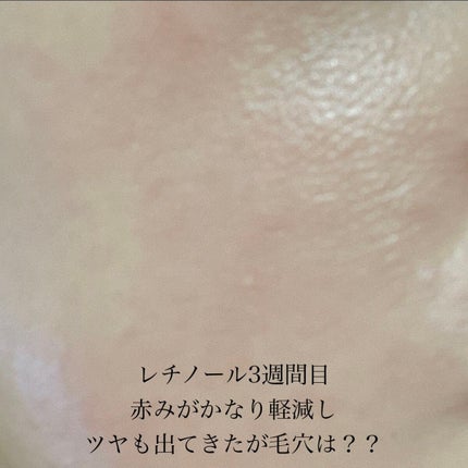 RXザ・レチノール0.1クリーム/COSRX/フェイスクリームを使ったクチコミ(6枚目)