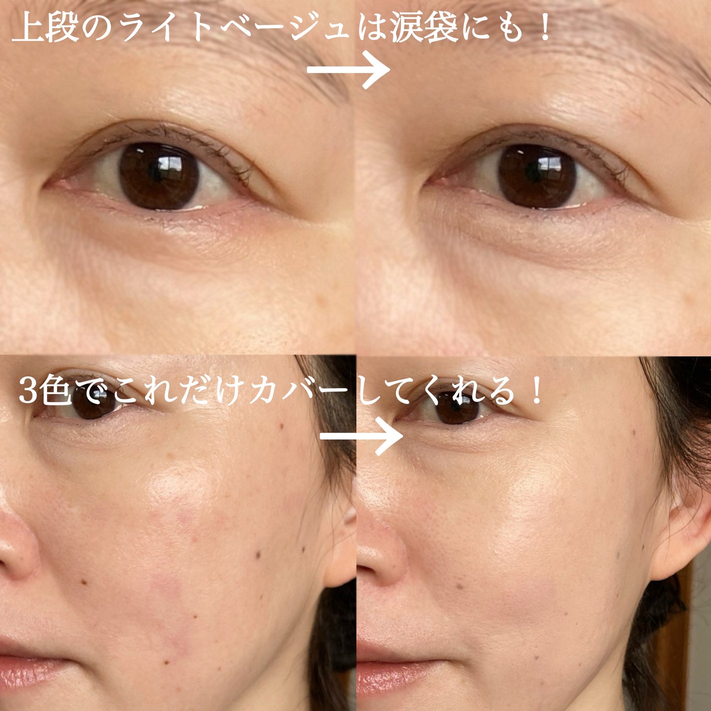 カバーパーフェクトコンシーラー/upink/パレットコンシーラーを使ったクチコミ(5枚目)