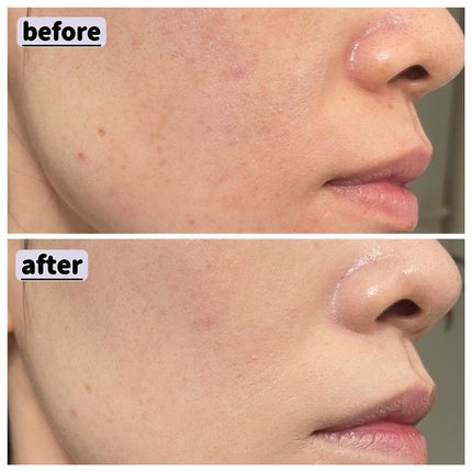 natsu on LIPS 「...乾燥肌・ツヤ肌好きさん向けクッションファンデ!まさに乾燥..」(4枚目)