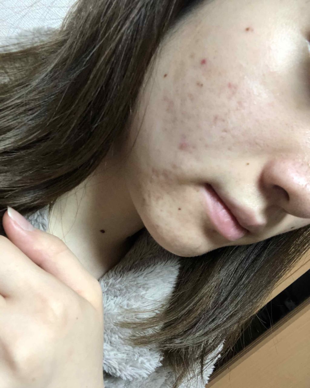 マンスリースキンケアプログラム(旧)/APEX/スキンケアキットを使ったクチコミ（3枚目）