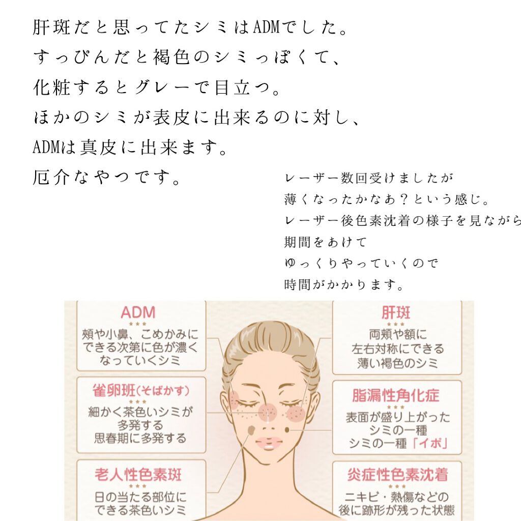 ビューティー カバーペンシル スリム-1/三善/ペンシルコンシーラーを使ったクチコミ（2枚目）