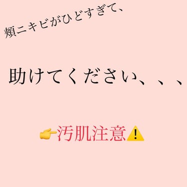 2枚目以降写真閲覧注意⚠️です！！！

私は今18歳なのですが、少し前から頬のニキビがだんだんとでき始めました。
最初は小さいものだけだったんですが、最近は膿ニキビや大きいニキビばかりできてしまいコンシ