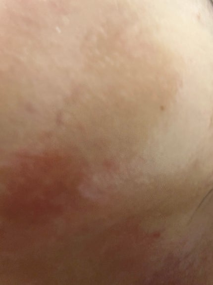 プロバイオダームタイトニングコラーゲンクリーム/BIOHEAL BOH/フェイスクリームを使ったクチコミ(1枚目)