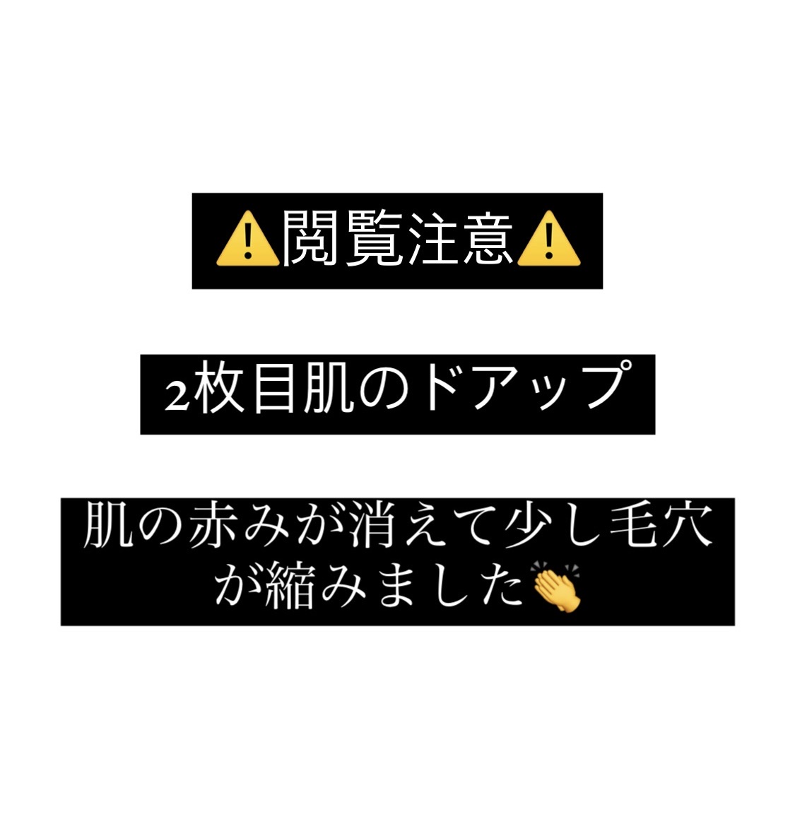 エリクシール ルフレ バランシング おやすみマスク/エリクシール/フェイスクリームを使ったクチコミ（1枚目）