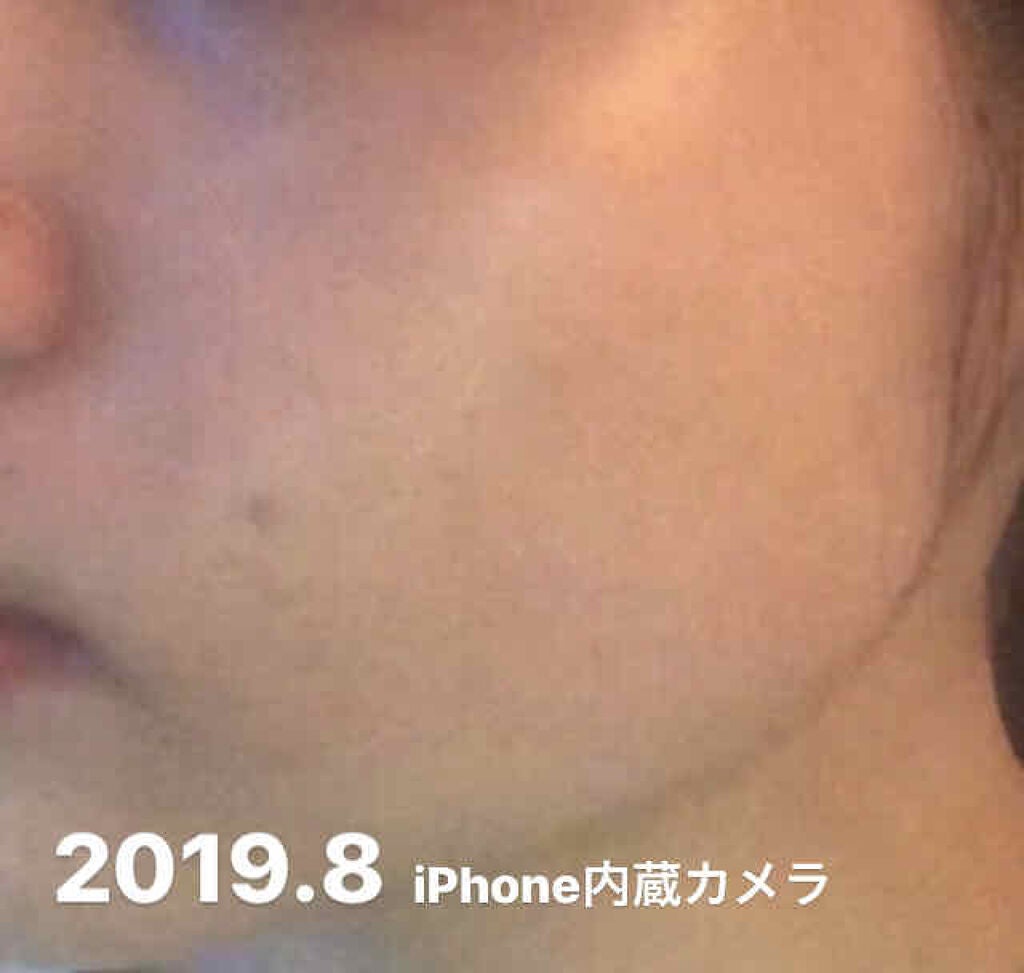 **むぎちゃん** on LIPS 「なぜ私が肌荒れしたのかおはようございます☀︎私自身、自分の肌荒..」(2枚目)