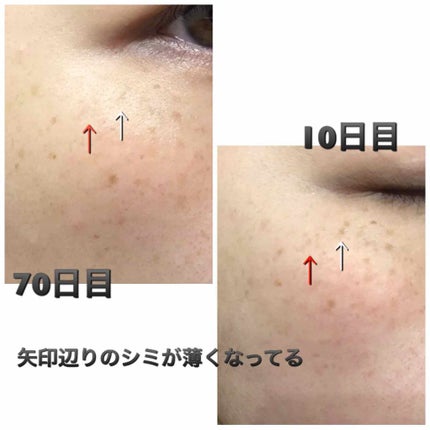 ブライトニングローション しっとり/DEW/化粧水を使ったクチコミ(3枚目)