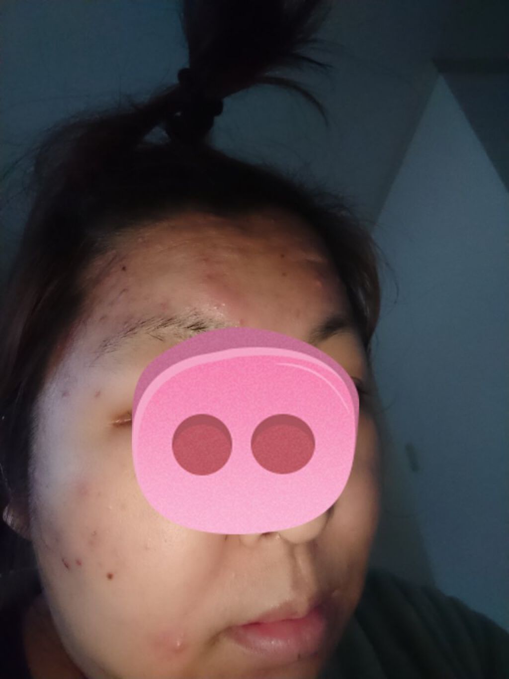 スチーマー ナノケア EH-SA3B/Panasonic/美顔器・マッサージを使ったクチコミ（1枚目）