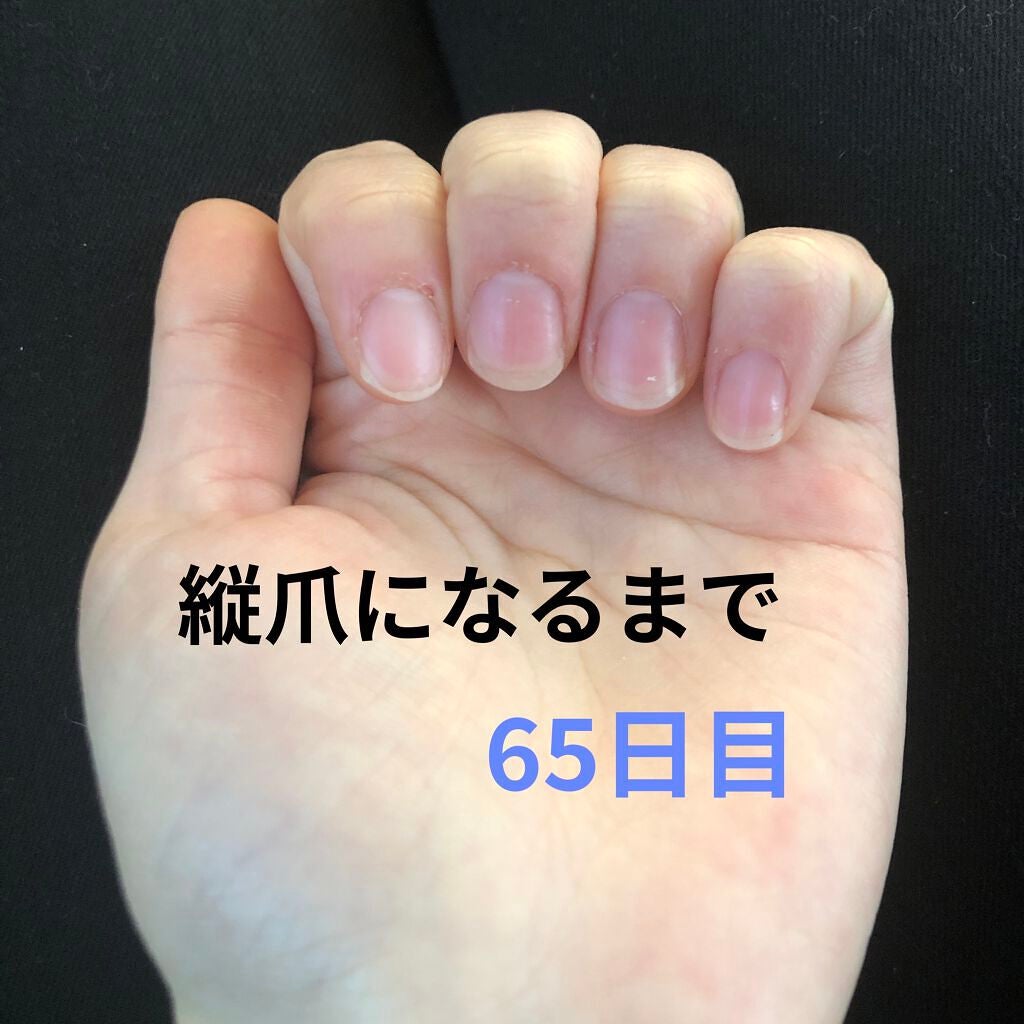 ð on LIPS ã瞊çªã«ãªãããã«ãããããªæ¹æ³ããã£ããæããŠãã ããðã¡ãªã¿..ãïŒ1æç®ïŒ