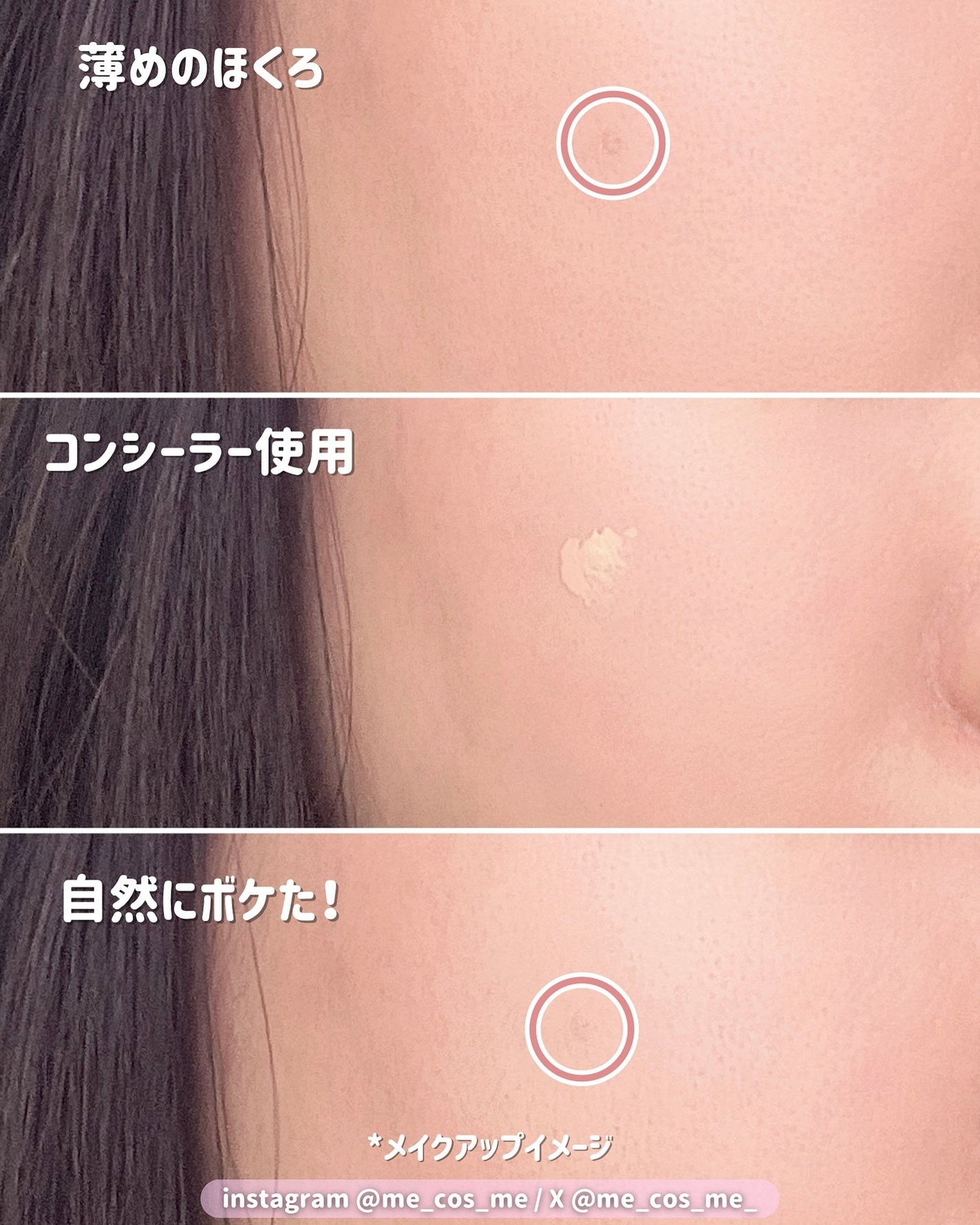 タトゥーウォータープルーフスカーコンシーラー/フォレンコス/リキッドコンシーラーを使ったクチコミ(2枚目)