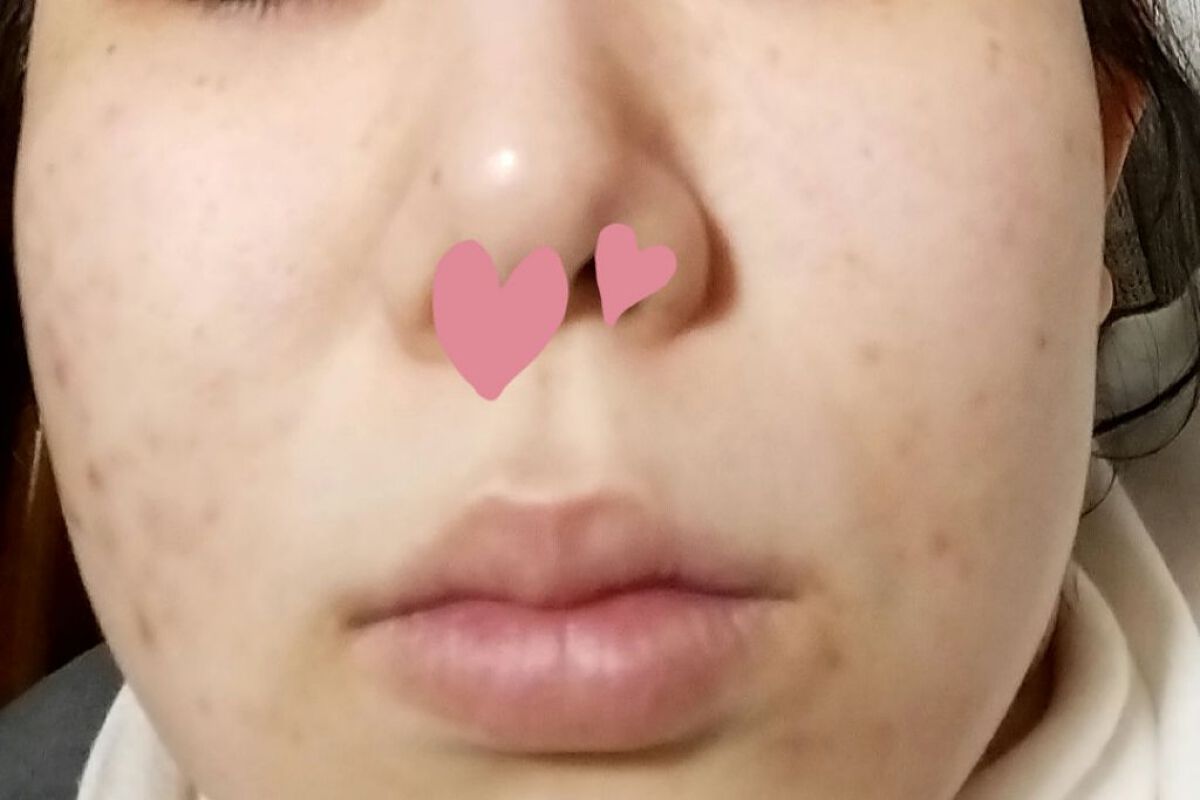 ガラクナイアシン2.0エッセンス/manyo/美容液を使ったクチコミ（3枚目）