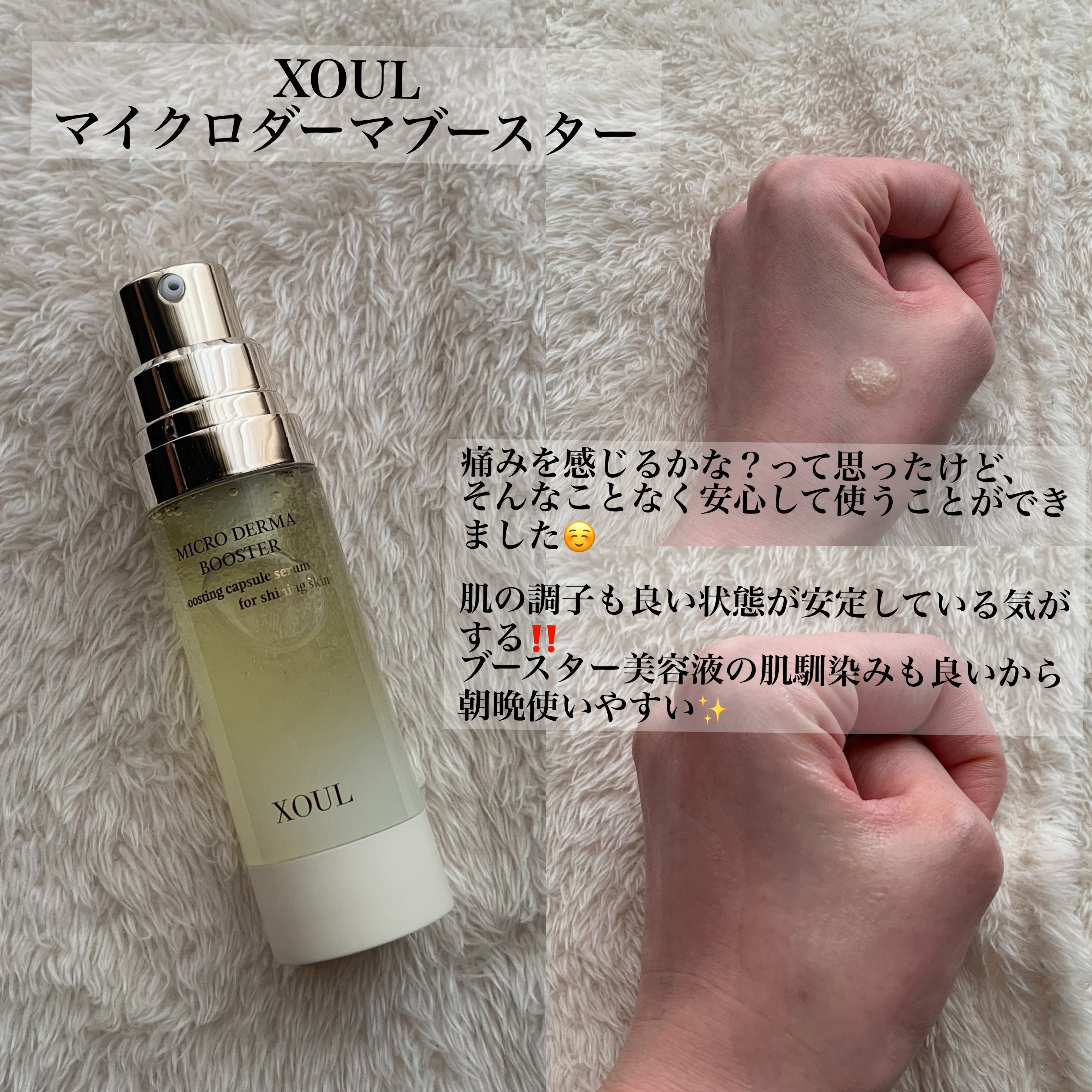 XOULさまよりいただきました🤍

マイクロダーマブースター

大好きな導入美容液の一つ
チクッとした痛みもほとんど感じずに使うことができるので、痛みが苦手な人に、ぜひオススメしたい☺️

3月のQoo10メガ割では、この導入美容液は3本