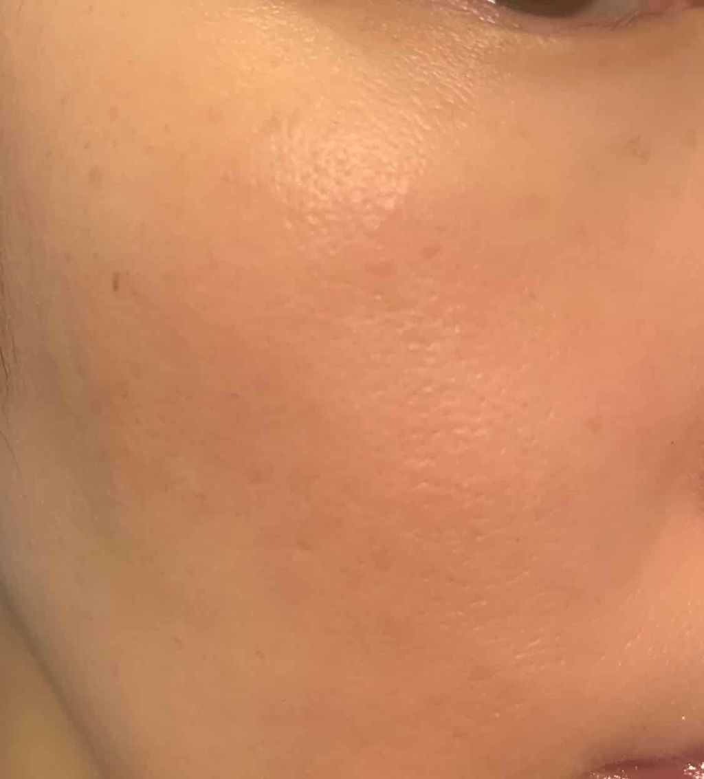 レイチェル ワイン ミネラルファンデーションのクチコミ「⚠️2枚目、3枚目にiPhoneインカメ撮影、無加工の肌が出て来ますのでご注意を！！⚠️

4.....」（2枚目）