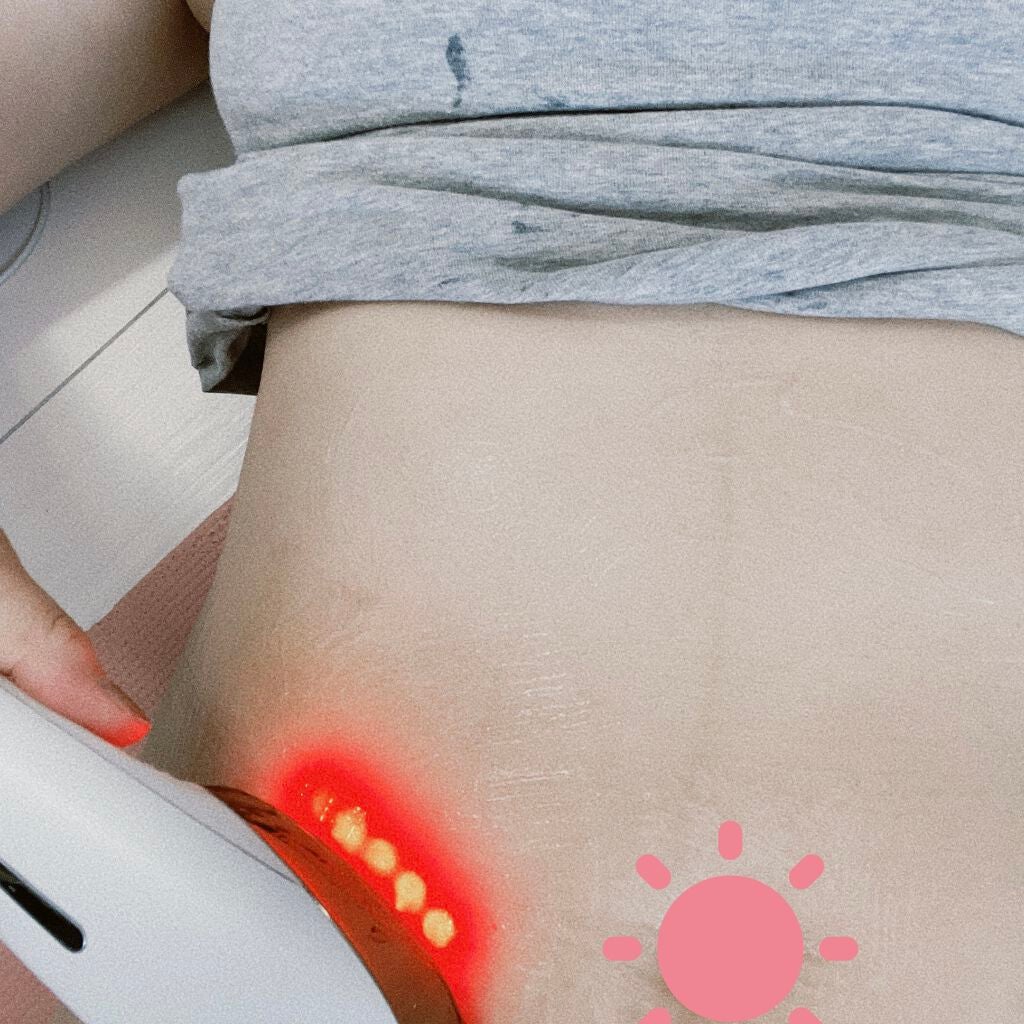 スカルプリフト/mysé(ミーゼ)/ヘアケアグッズを使ったクチコミ(1枚目)