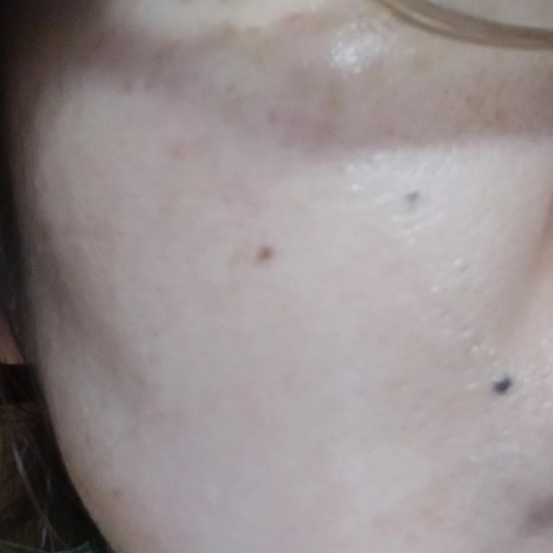 PDRNショット675/COSNORI/美容液を使ったクチコミ（3枚目）