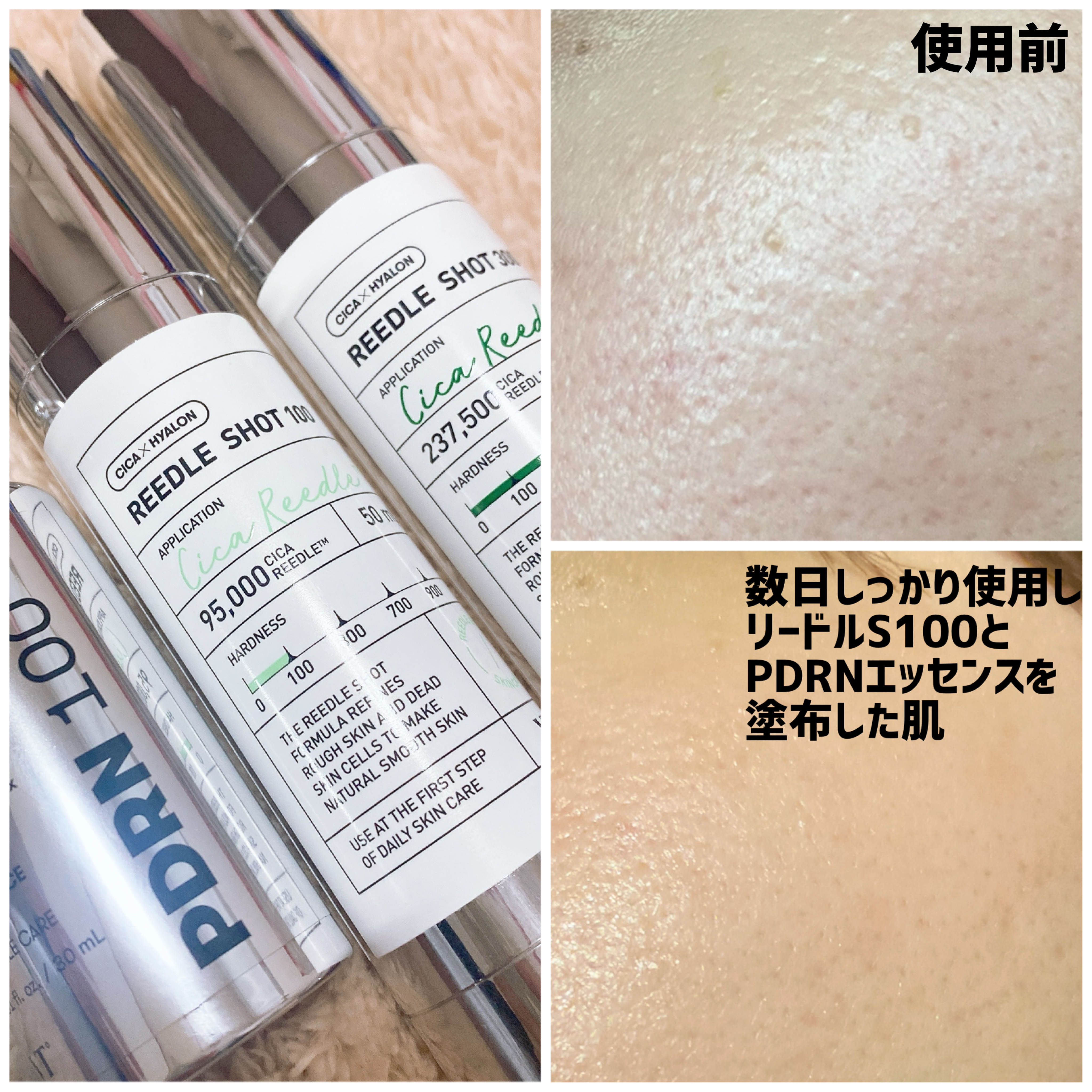 リードルショット300/VT/美容液を使ったクチコミ（2枚目）