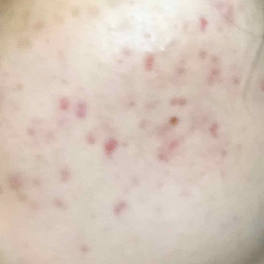 ヴァセリン アドバンスドリペア ボディローション 無香料/ヴァセリン/ボディローションを使ったクチコミ（2枚目）