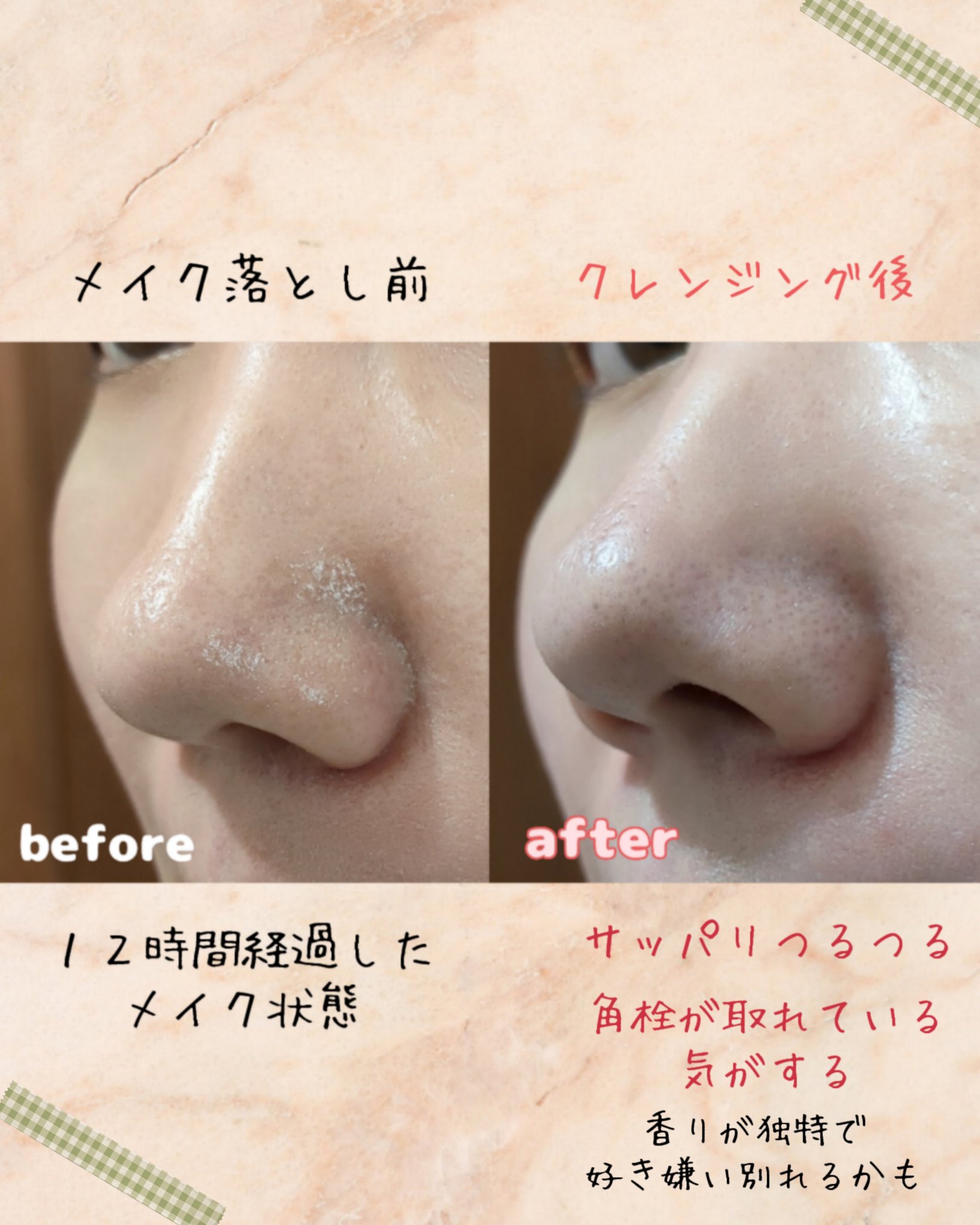 One-day's you ワンデイズユー ディープクレンジグオイルのクチコミ「毛穴の黒ずみに悩む私が今回使ってみたのはOne-day's youのクレンジングオイル✨ぜひ参.....」（3枚目）