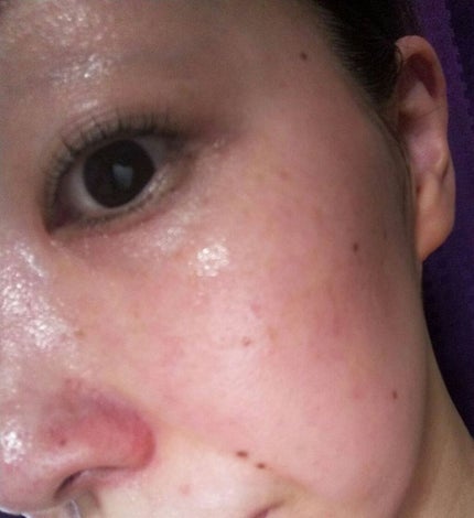 インビジブルピーリングブースターエッセンス/CNP Laboratory/ブースター・導入液を使ったクチコミ(4枚目)