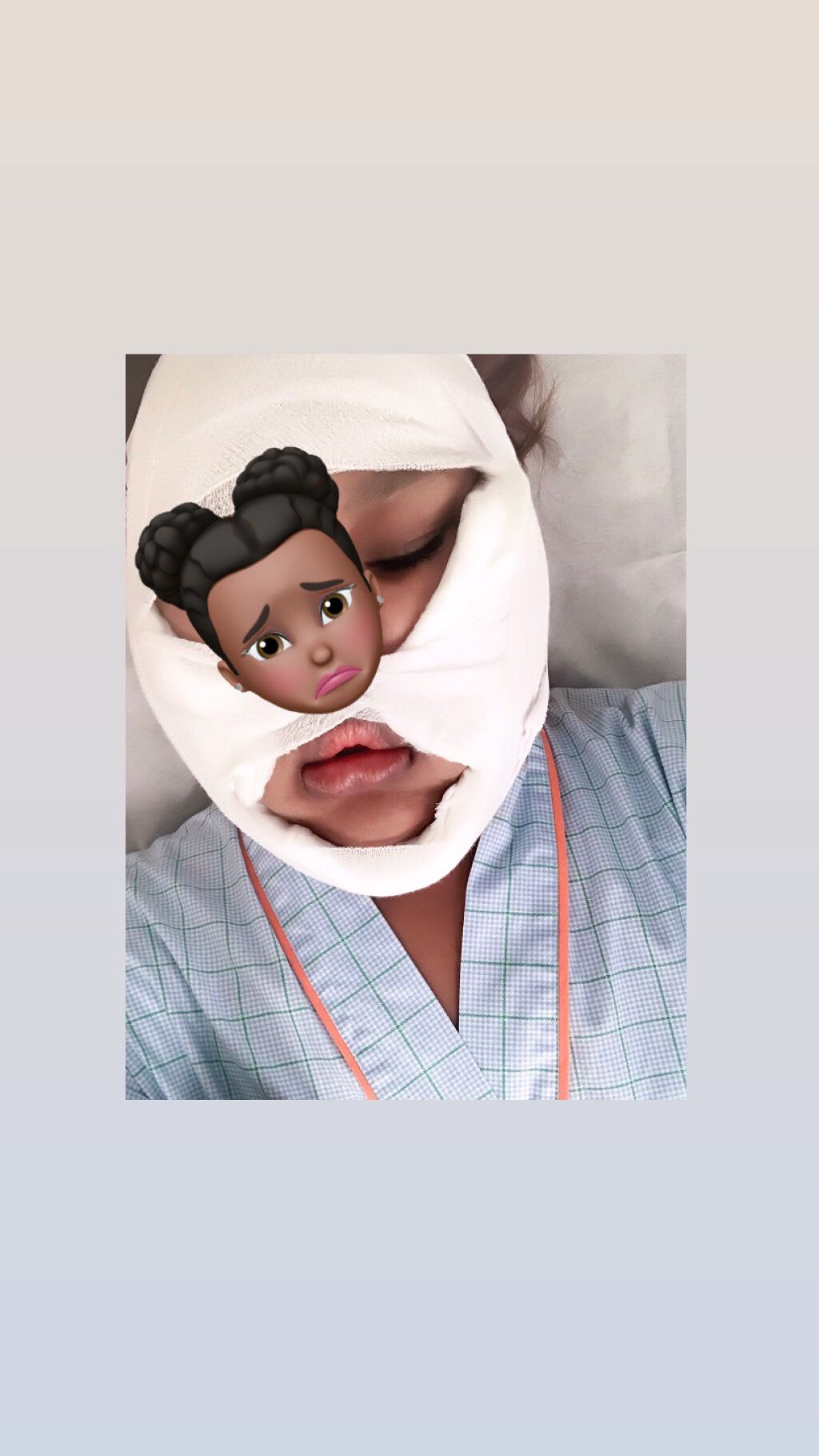 Nの美容アカウント♡(減量中) on LIPS 「混血ちゃんの美容整形事情第一弾🎉〜脂肪吸引(頬&顎下)編〜正直..」(2枚目)