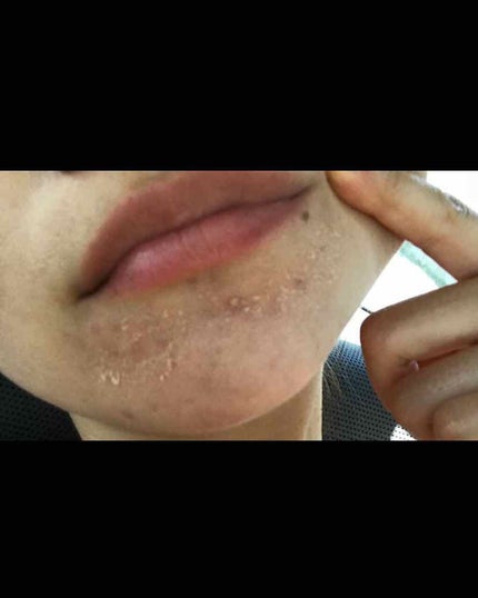 ルミスパ スターター キット/ニュースキン/美顔器・マッサージを使ったクチコミ(1枚目)