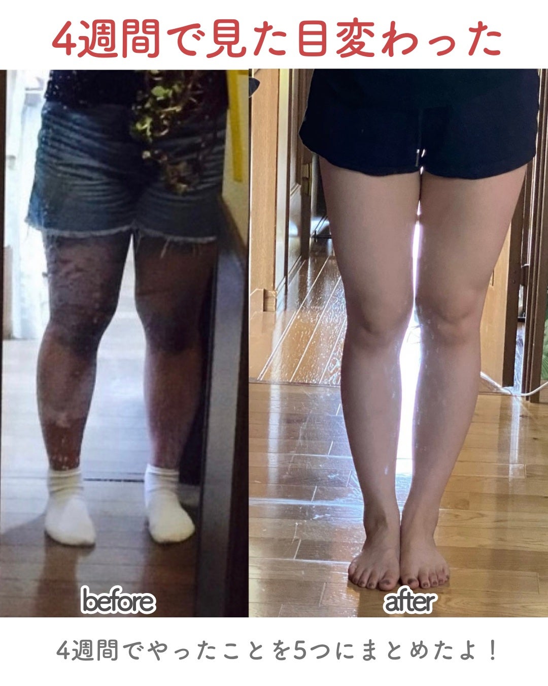 寝ながらメディキュット ロング/メディキュット/着圧ソックス・レギンスを使ったクチコミ(2枚目)