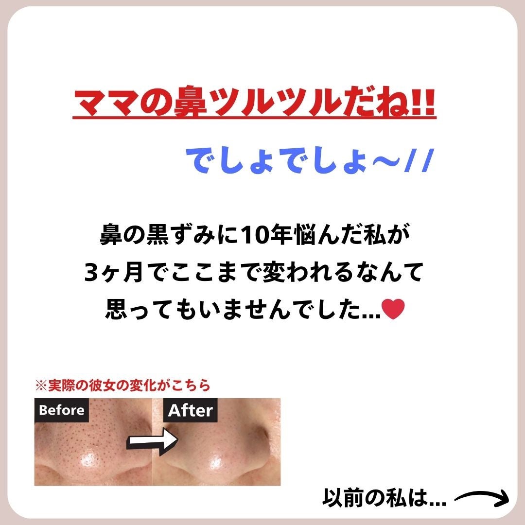 あなたの肌に合ったスキンケア💐コーくん先生 on LIPS 「【知らないと損】エグいほど鼻の黒ずみが消える方法🫢..あなたの..」(2枚目)