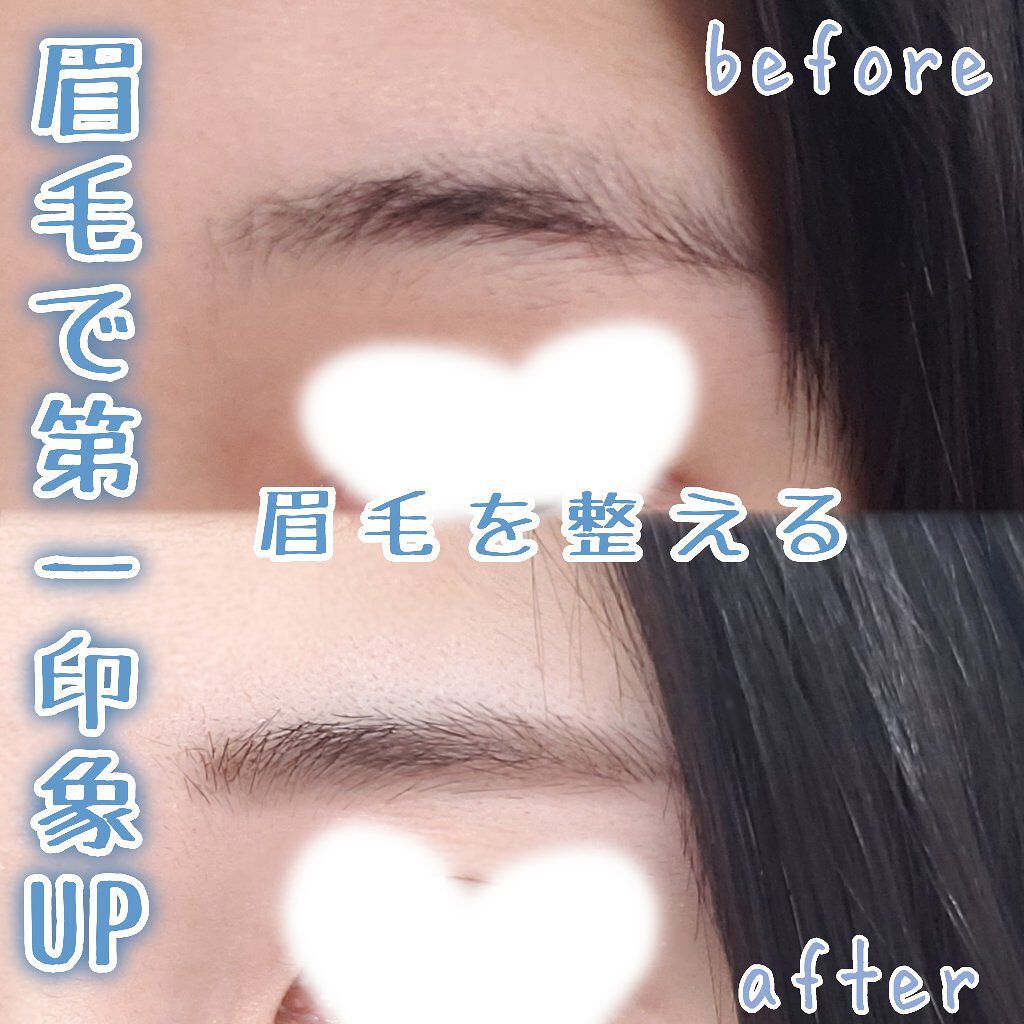 プレミア敏感肌用 Lディスポ/シック/シェーバーを使ったクチコミ（1枚目）