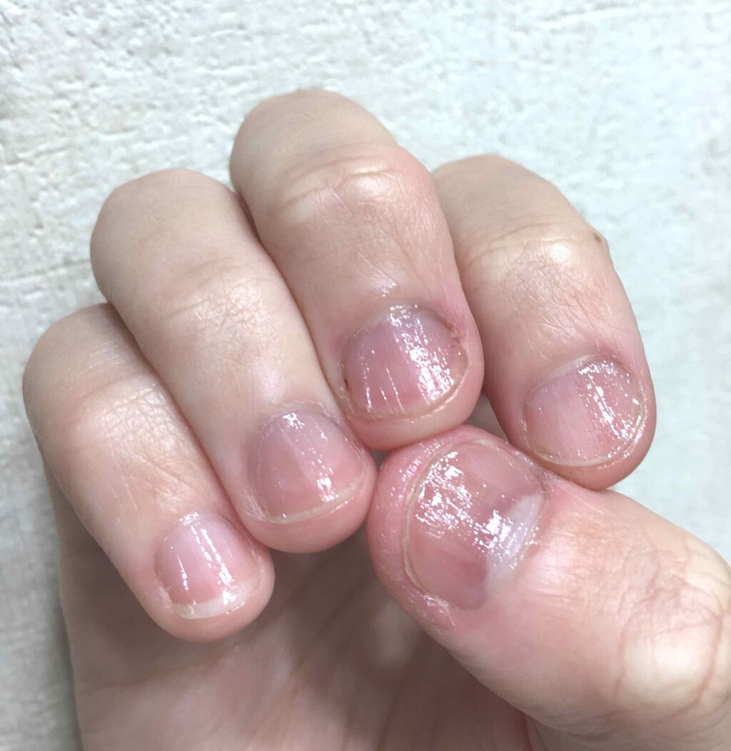 ネイルケアオイル/無印良品/ネイルオイル・トリートメントを使ったクチコミ（3枚目）