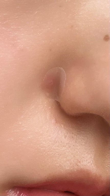 ティーツリーカーミングスポットパッチ/MEDIHEAL/その他スキンケアを使ったクチコミ(2枚目)