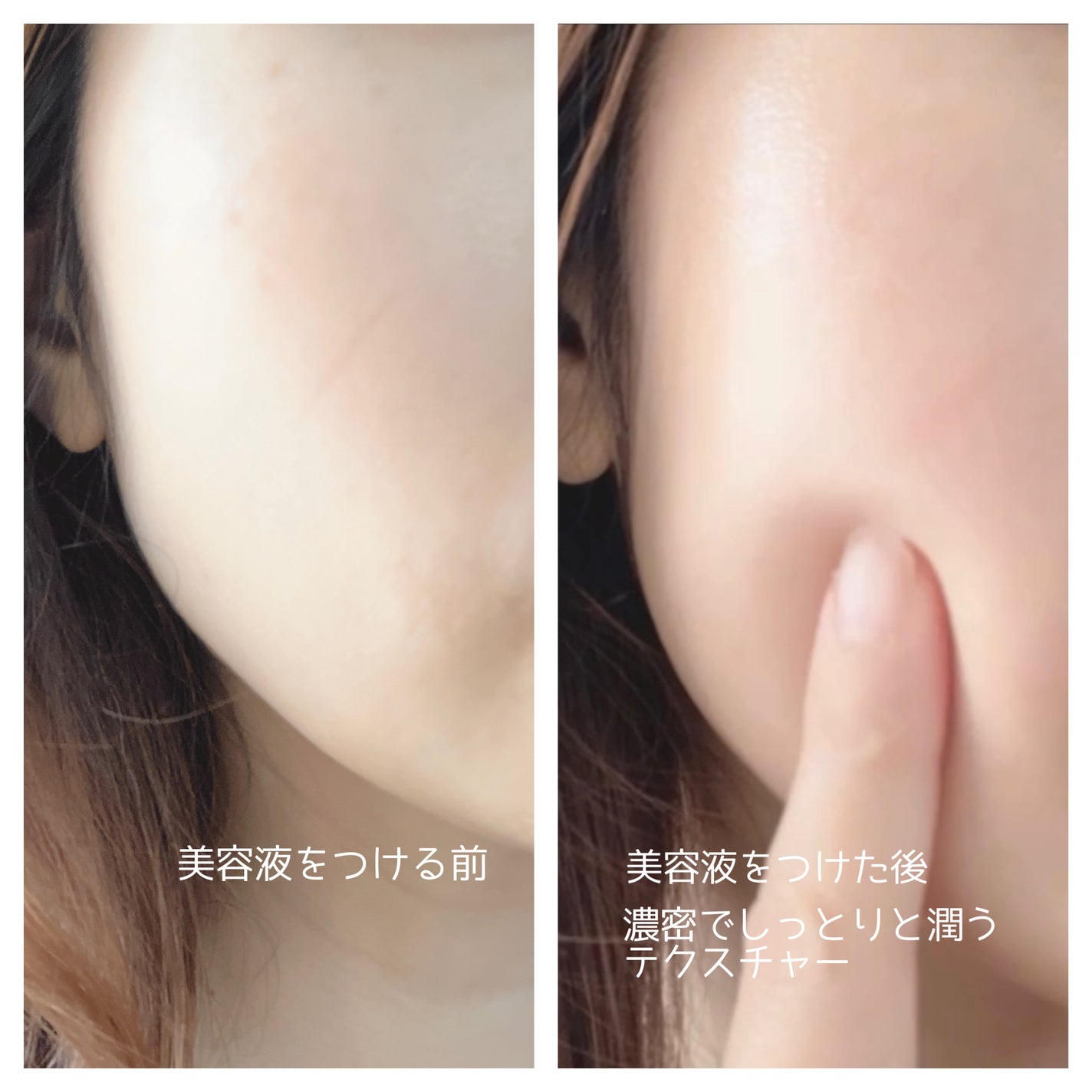 ディープビタCアンプル2.0/MEDICUBE/美容液を使ったクチコミ(5枚目)