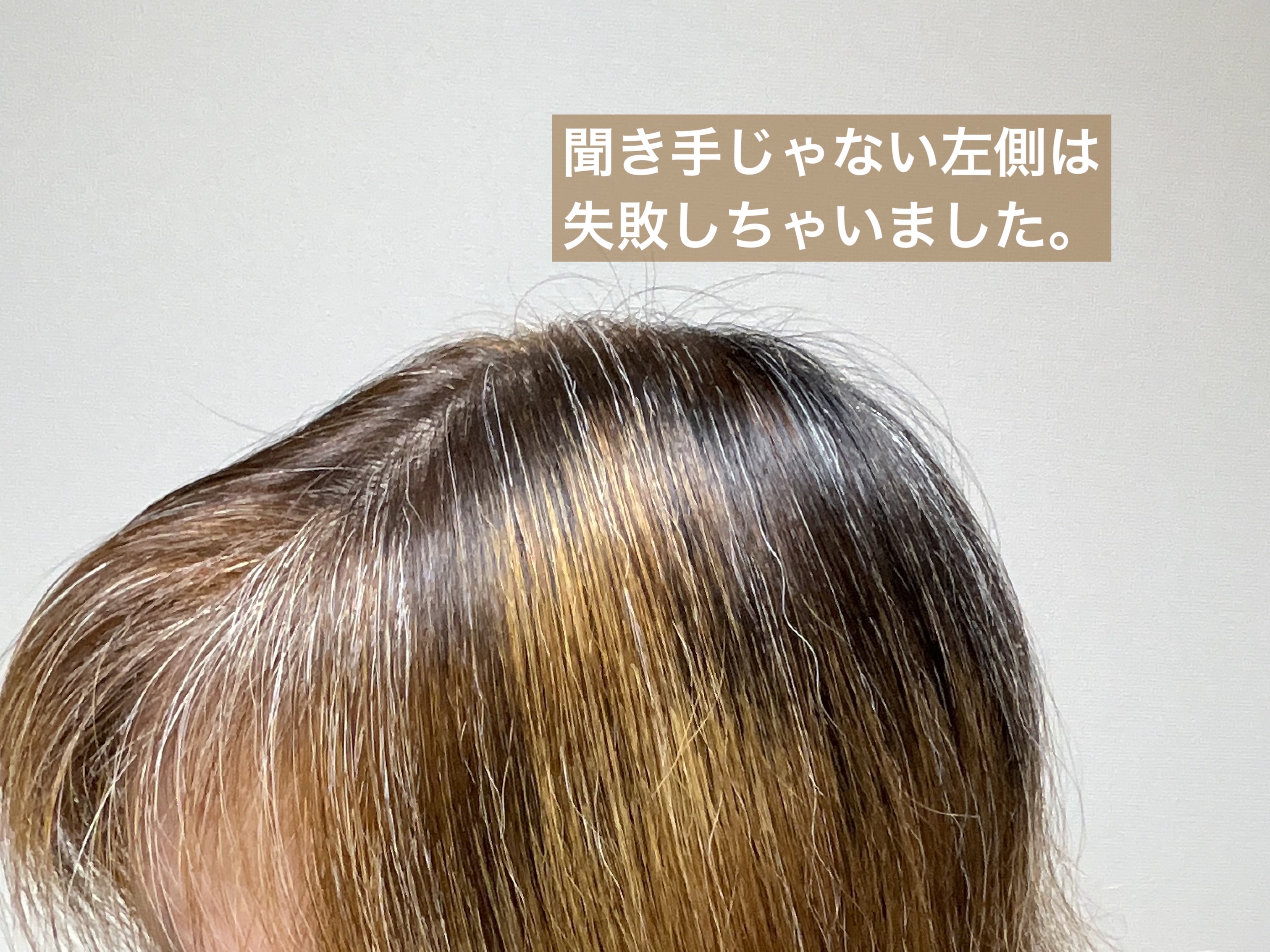 ベースアップブリーチ/ビューティーン/ブリーチ剤を使ったクチコミ（3枚目）