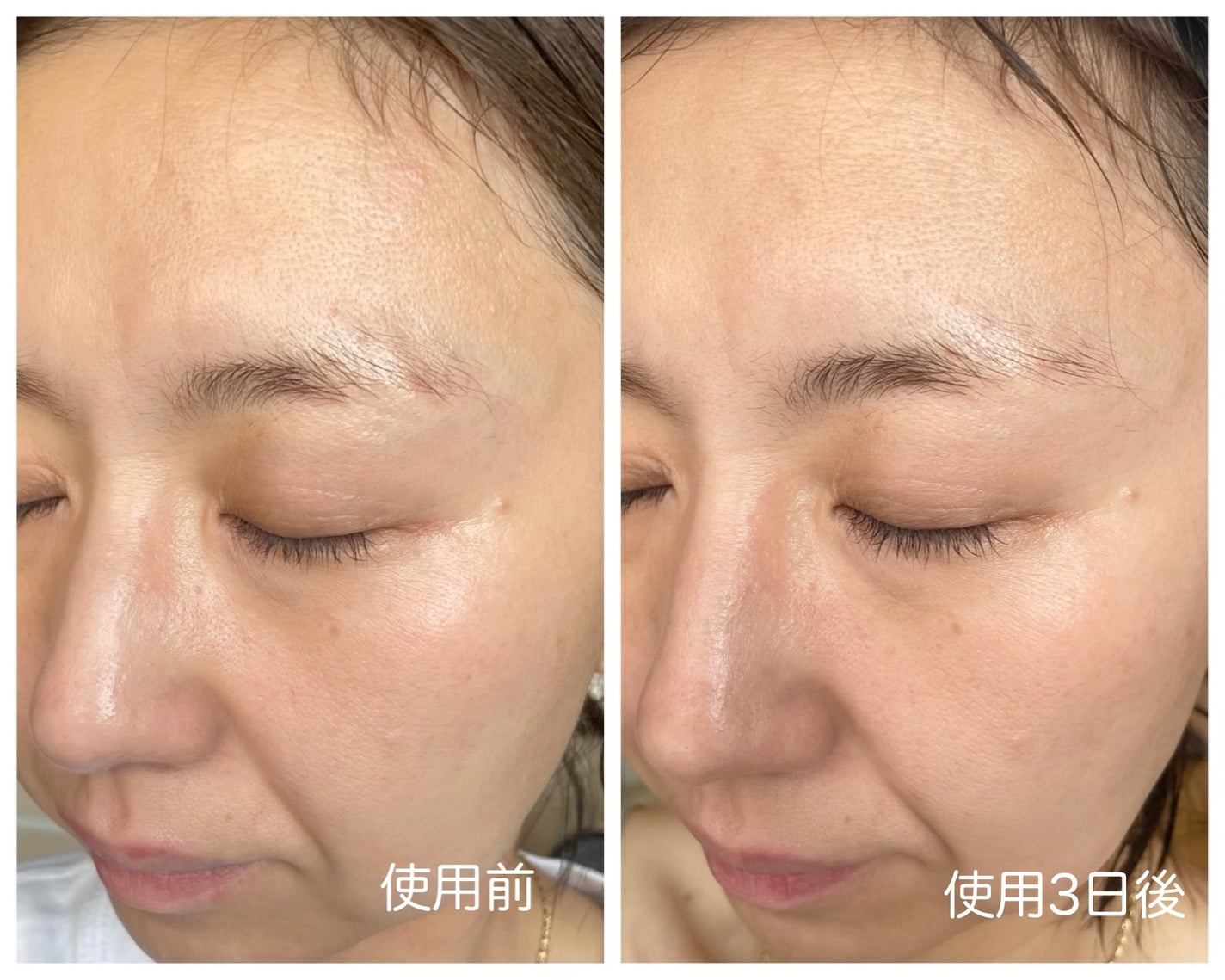 リードルショット300/VT/美容液を使ったクチコミ(4枚目)