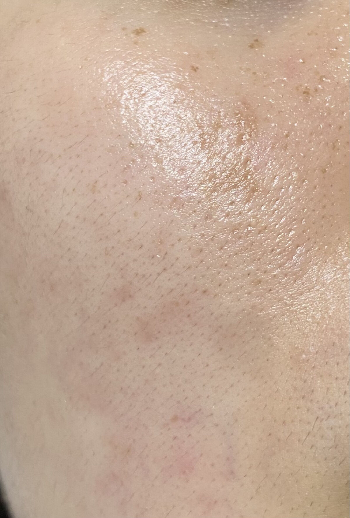 Rエッセンス/unlabel/美容液を使ったクチコミ（3枚目）