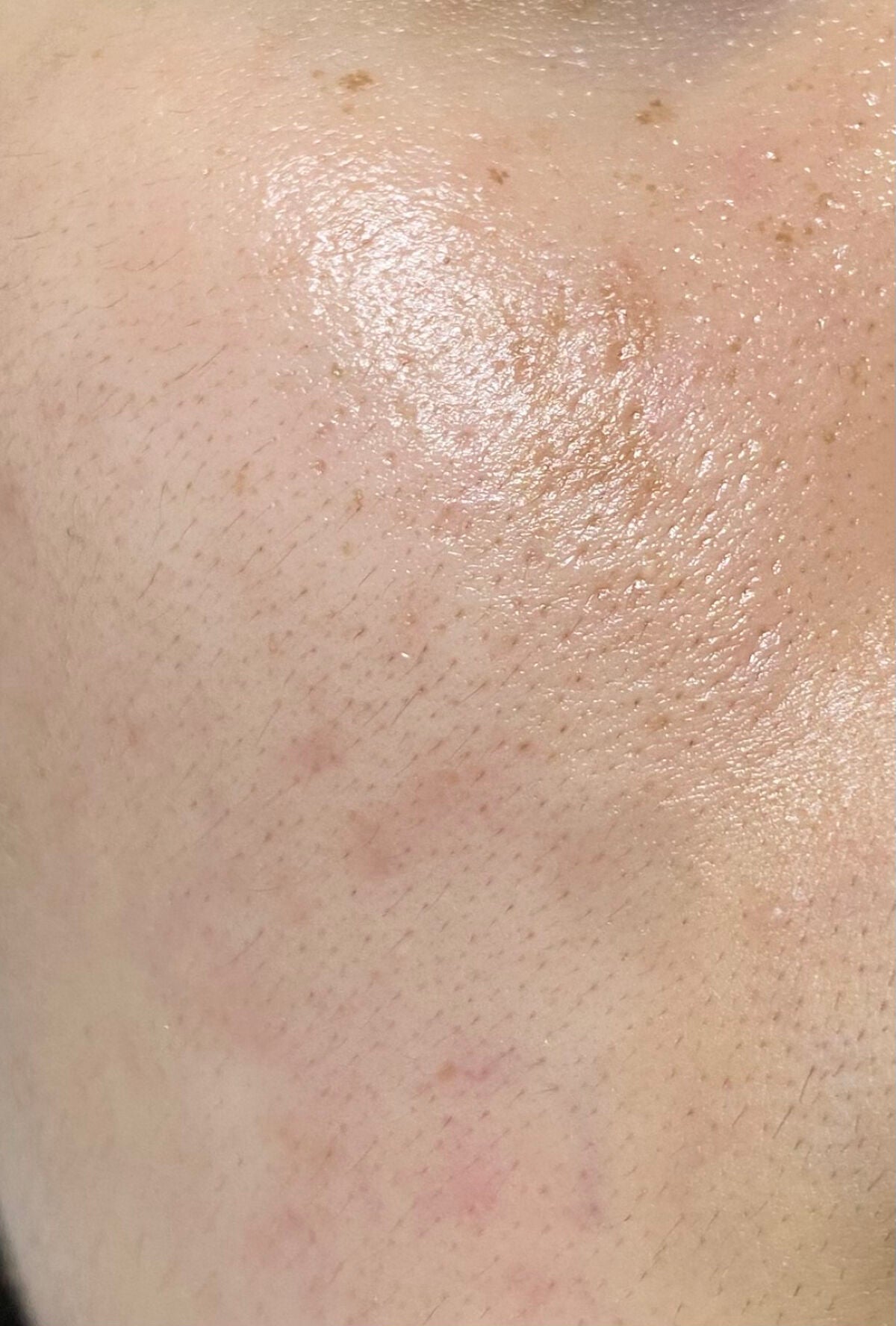 Rエッセンス/unlabel/美容液を使ったクチコミ(3枚目)