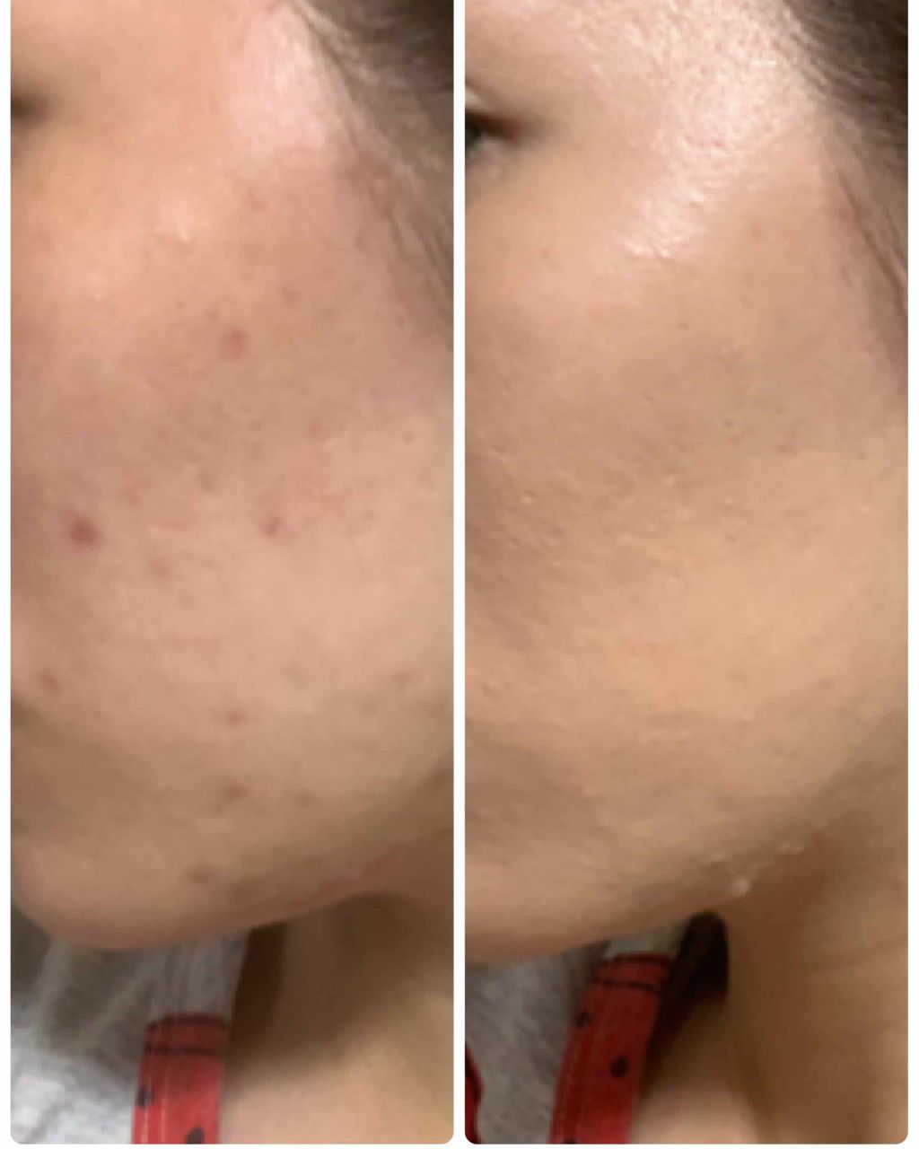 カバーパーフェクション チップコンシーラー/the SAEM/リキッドコンシーラーを使ったクチコミ(2枚目)