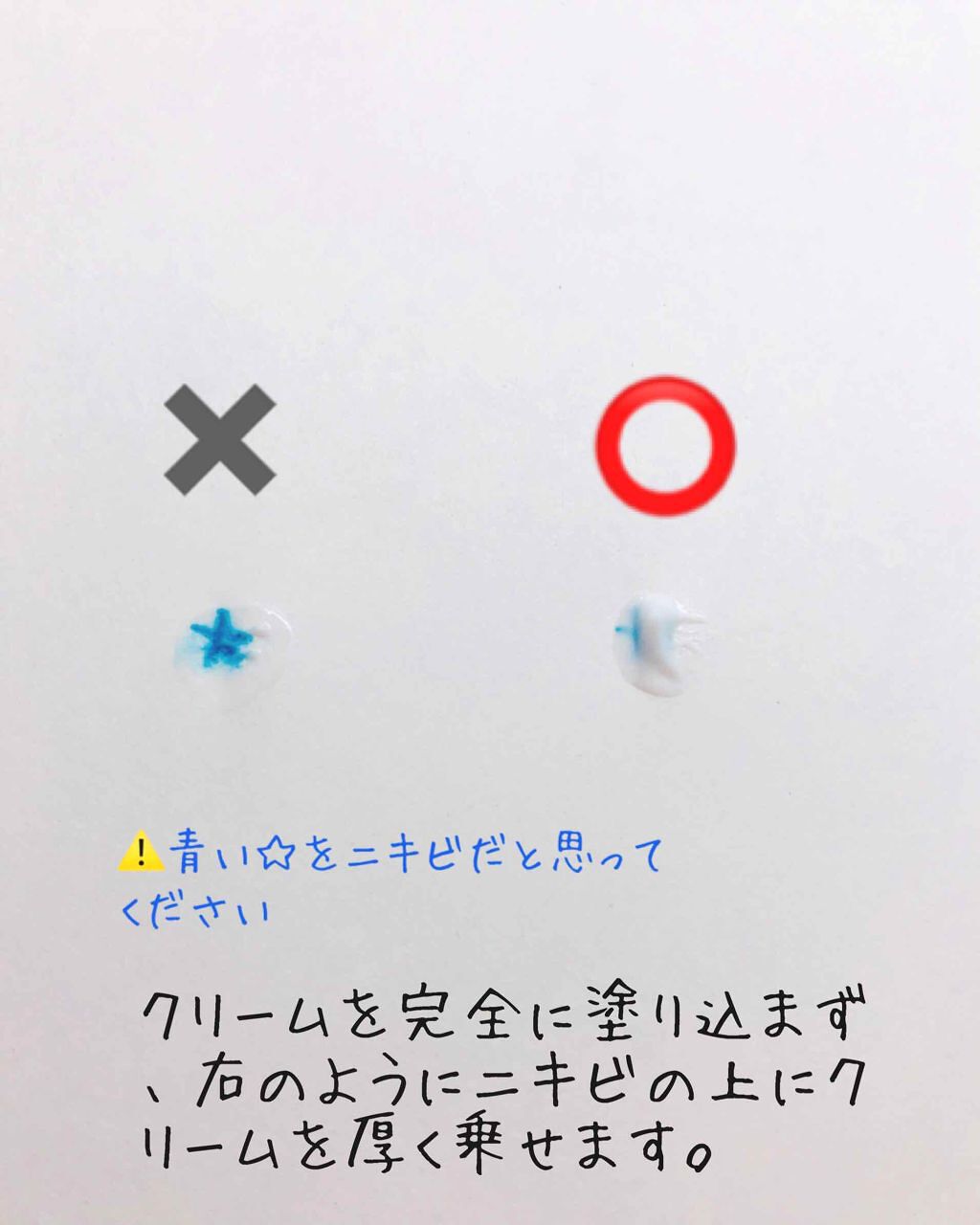 ペアアクネクリームW(医薬品)/ペア/その他を使ったクチコミ（3枚目）