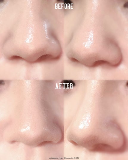 コントゥアスティック/ETUDE/シェーディングを使ったクチコミ(5枚目)