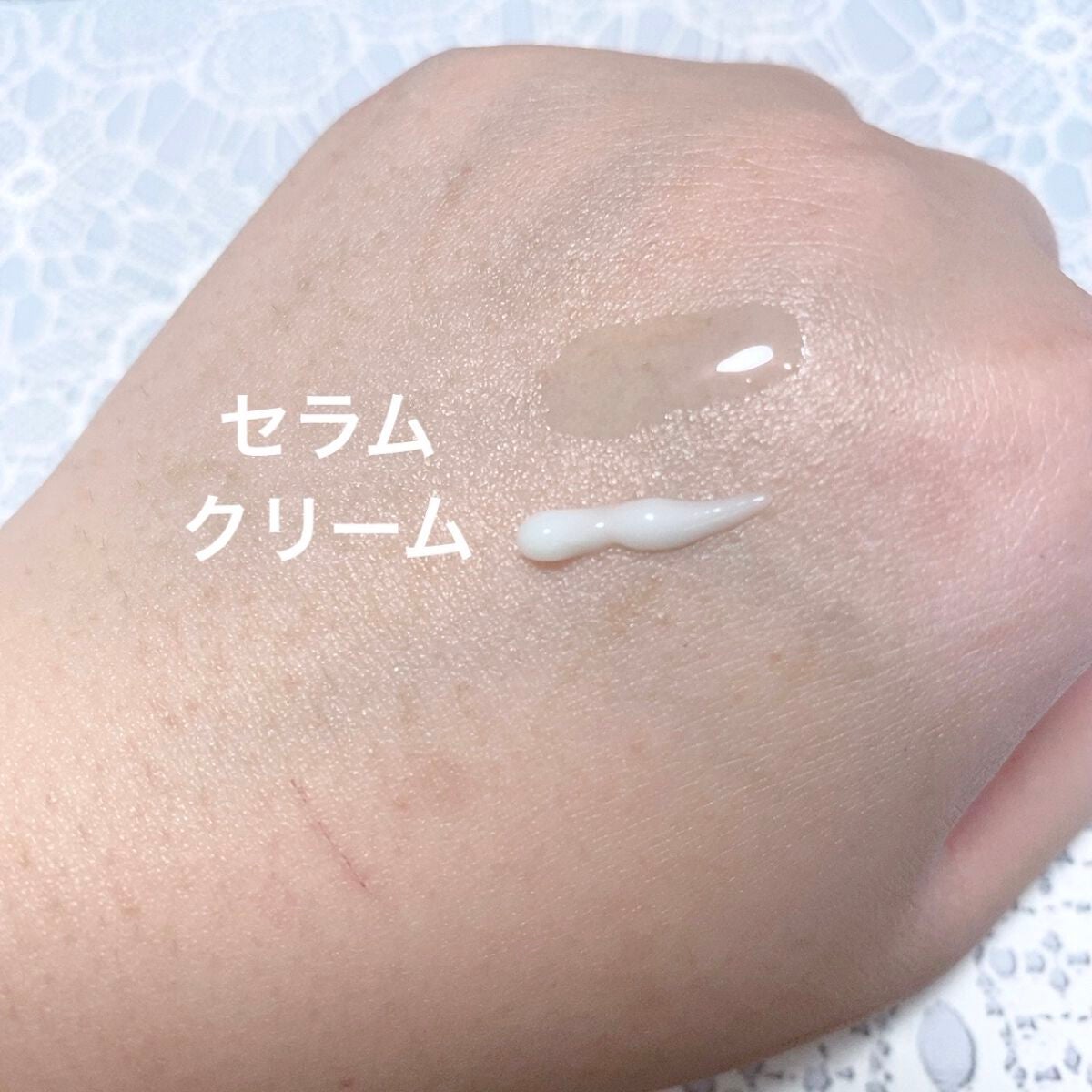 さゆみん♡韓国コスメ on LIPS 「FORENCOSトナー(化粧水)ハイドレーションセラム(美容液..」(6枚目)