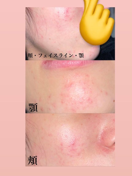 ã䜿ã£ãã¯ãã³ãïŒ2æç®ïŒ