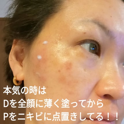 バデカシルプラスP/23years old/フェイスクリームを使ったクチコミ(4枚目)