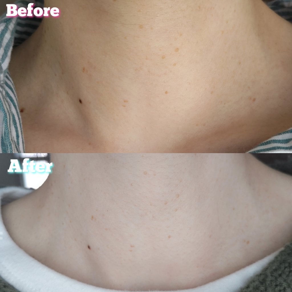 薬用ピーリングスムーサーEXW/シーヴァ/ピーリングを使ったクチコミ(5枚目)