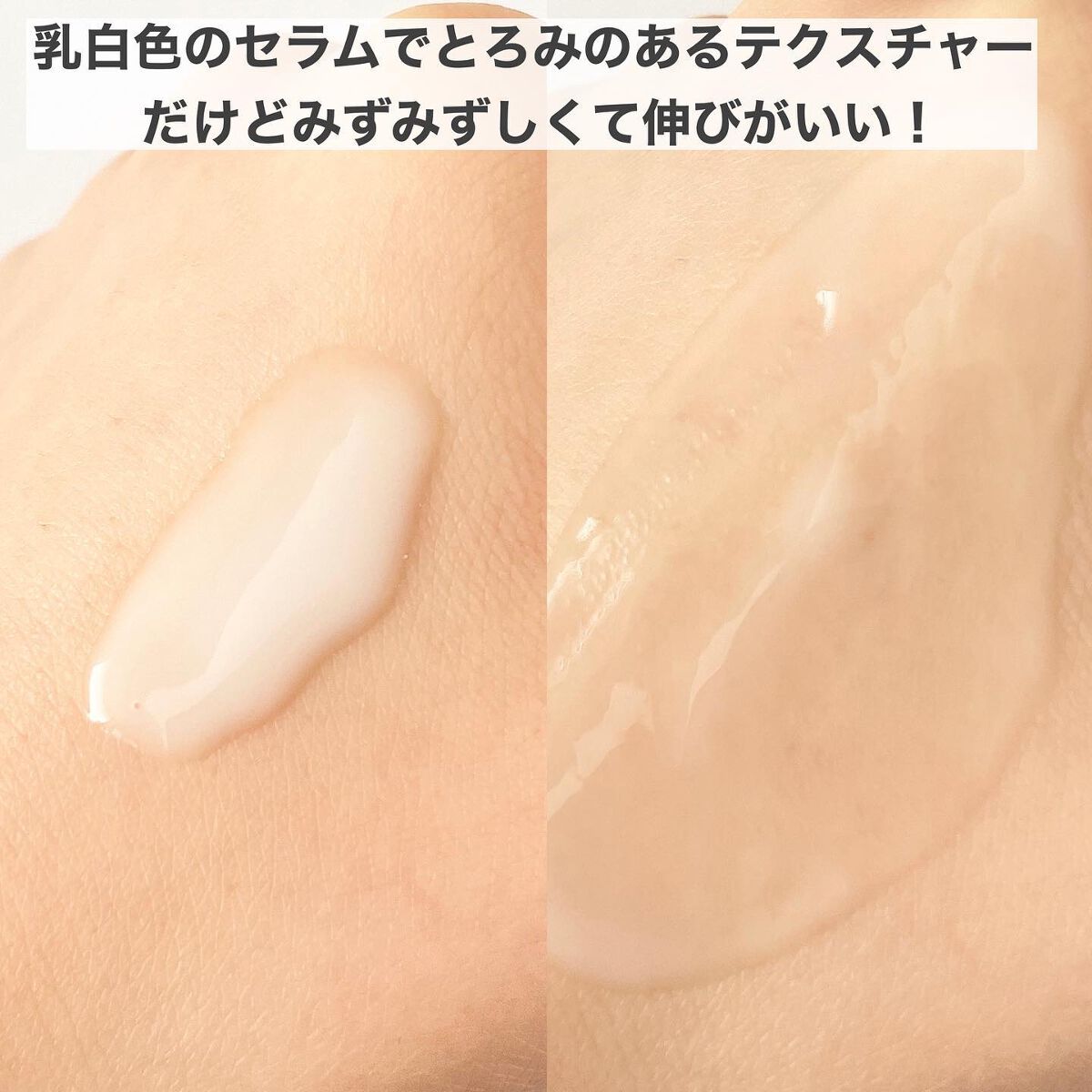 バリアダームミルキーセラム/SKIN&LAB/美容液を使ったクチコミ(4枚目)