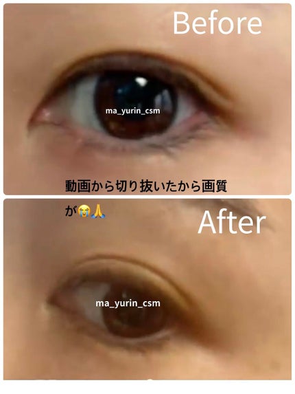 オリシキ アイリッドスキンフィルム /D-UP/二重まぶた用アイテムを使ったクチコミ(3枚目)