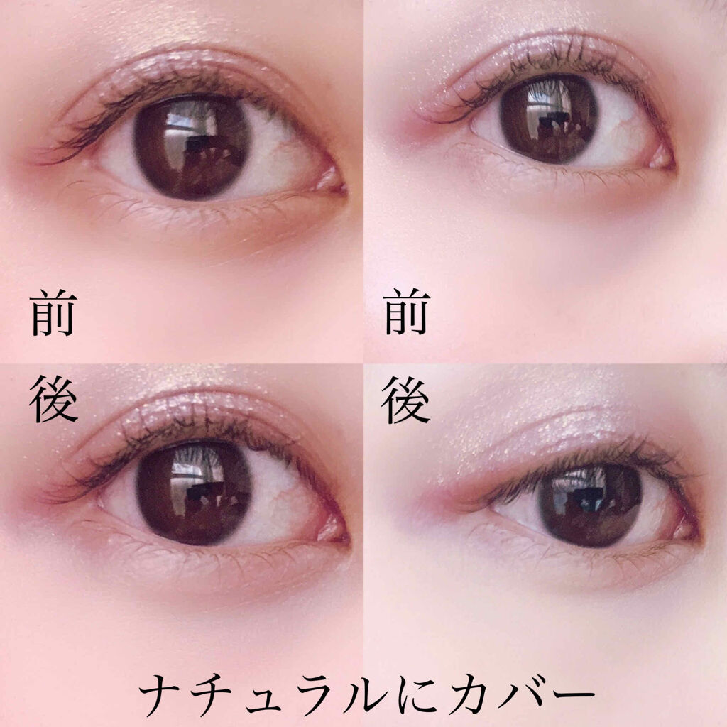 【旧】ディオールスキン フォーエヴァー スキン コレクト コンシーラー/Dior/リキッドコンシーラーを使ったクチコミ（3枚目）