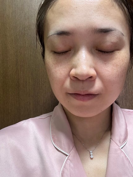 CICA デイリースージングマスク/VT/シートマスク・パックを使ったクチコミ(5枚目)