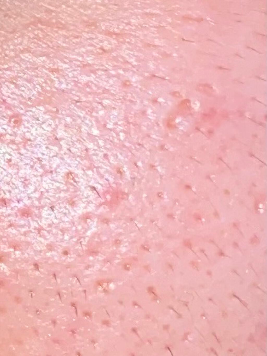 ガラス on LIPS 「お久しぶりですポトフです最近ネガティブ思考が止まらなくなって「..」(2枚目)