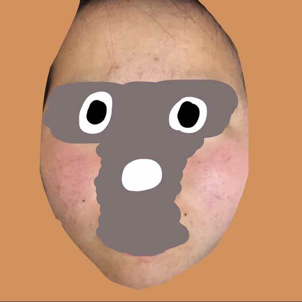 薬用 しみ 集中対策 美容液/メラノCC/美容液を使ったクチコミ(2枚目)