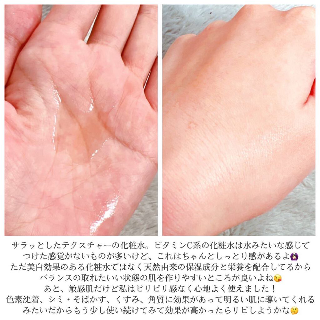 ガラクトミセスピュアビタミンCグロートナー/SOME BY MI/化粧水を使ったクチコミ（3枚目）