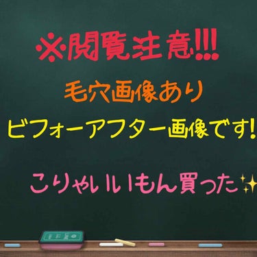 ロゼットゴマージュ/ロゼット/ピーリングを使ったクチコミ（1枚目）