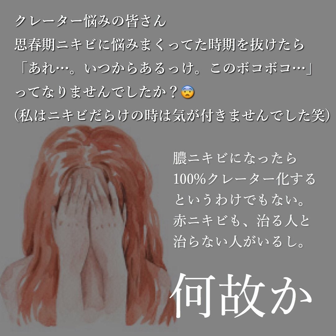 おゆみ|ニキビ・ニキビ跡ケア on LIPS 「【跡まで含めてニキビケアだよ】こんばんは。おゆみです。..」(2枚目)